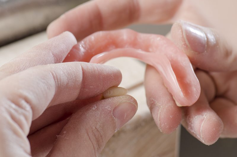 Denture reline service laboratory Sydney